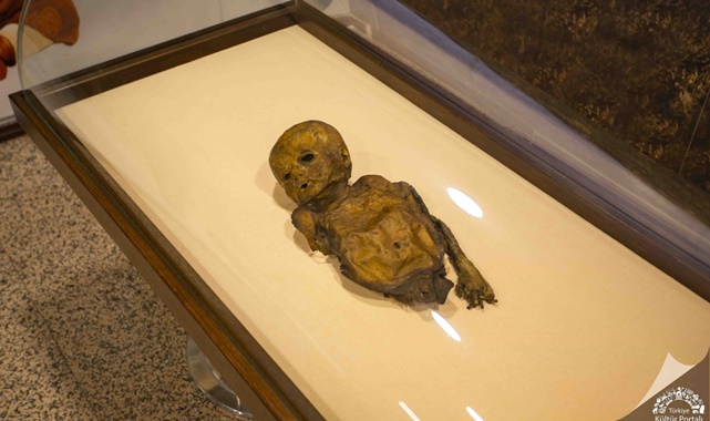 amasya müzesi mumya